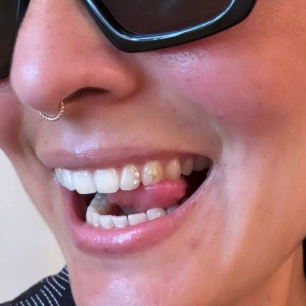 18kt Solid Gold Tooth Gem Jewelry One Solar Star